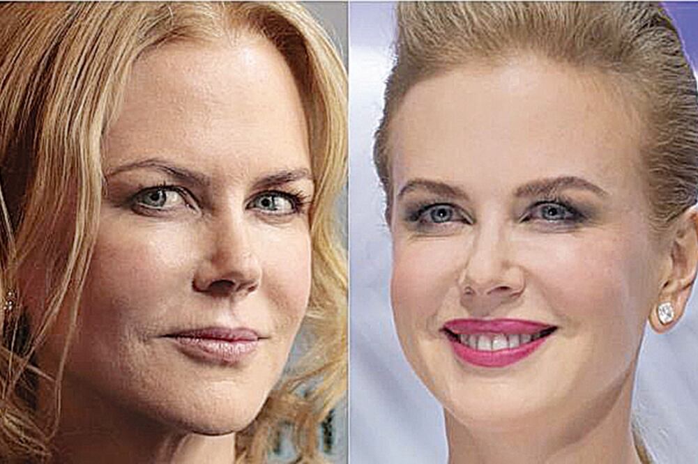 Así luce la nueva cara de Nicole Kidman