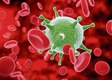 ¿Qué es un choque séptico y por qué es importante su diagnóstico oportuno?