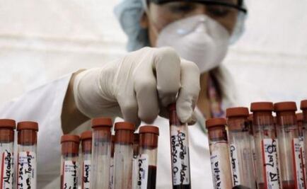 Vacuna contra el VIH logra controlar virus sin necesidad de fármacos