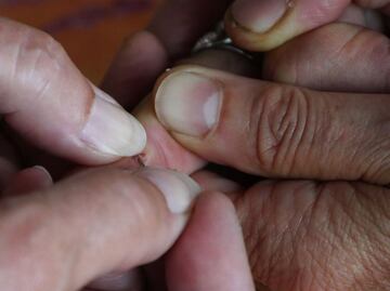 La planta insignia de la medicina ayurvédica que ayuda a la cicatrización de heridas