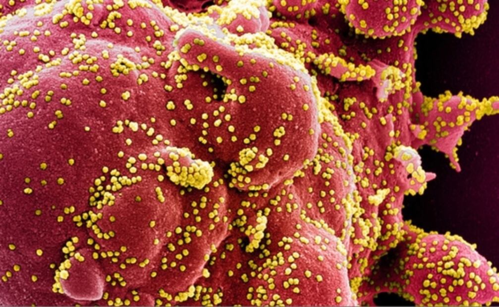 Descubren la proteína que provoca que nos enfermemos de Covid-19