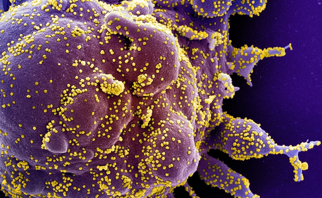 Foto: EFE/EPA/NIAID/NATIONAL INSTITUTES OF HEALTH HANDOUT 