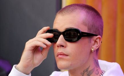 Justin Bieber padece el síndrome de Ramsay Hunt, ¿cuáles son los síntomas?