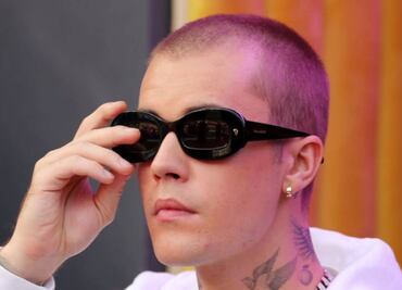 Justin Bieber padece el síndrome de Ramsay Hunt, ¿cuáles son los síntomas?