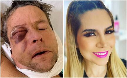 Alfredo Adame cuestiona con meme si la culpable de su golpiza fue Karla Panini