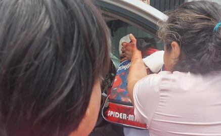 “Me lo desfiguraron”, asegura padre de menor de 5 años agredido por pitbull en Morelos