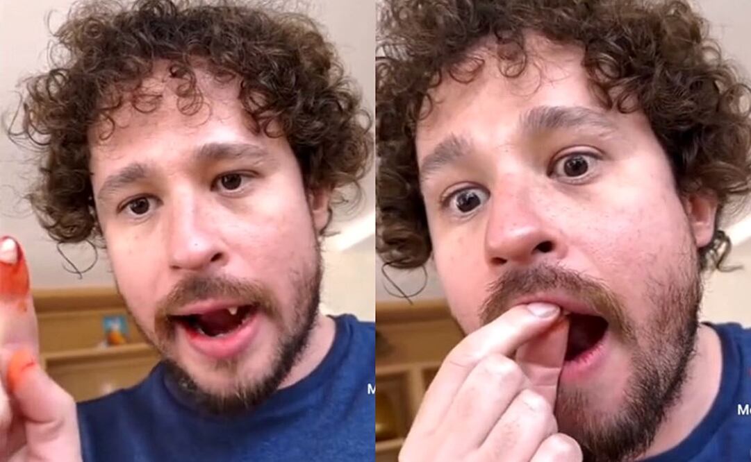 Luisito Comunica pidió ayuda al perder sus dientes. Foto: Instagram