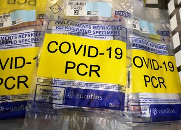 Pruebas PCR contra el Covid-19; guerra de precios y mercado negro