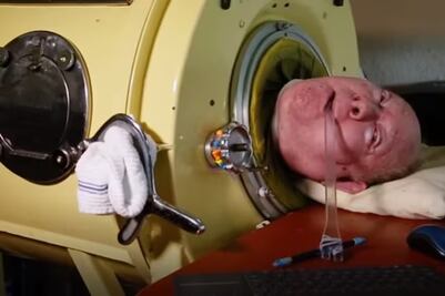 Muere Paul Alexander, el hombre que vivió 70 años en un "pulmón de acero"