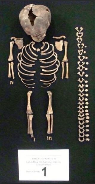 Restos fósiles de dos niños hallados al norte de la Ciudad de México.
Foto: INAH