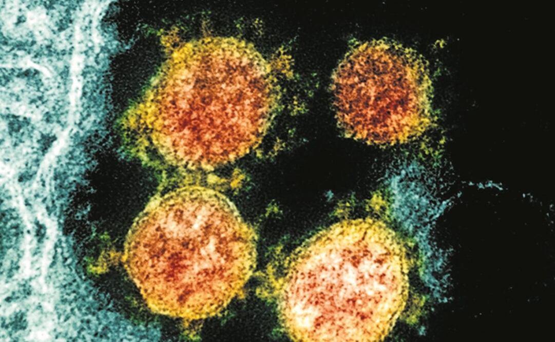 Foto: NIAID/National Institutes of Health via AP