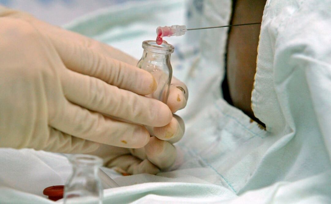 Alrededor de 10 mil personas necesitan un transplante de médula ósea en México (Foto: Archivo/EFE)