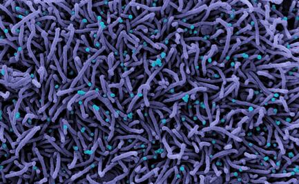 Mapean daño que ocasiona el Covid-19 en el cerebro