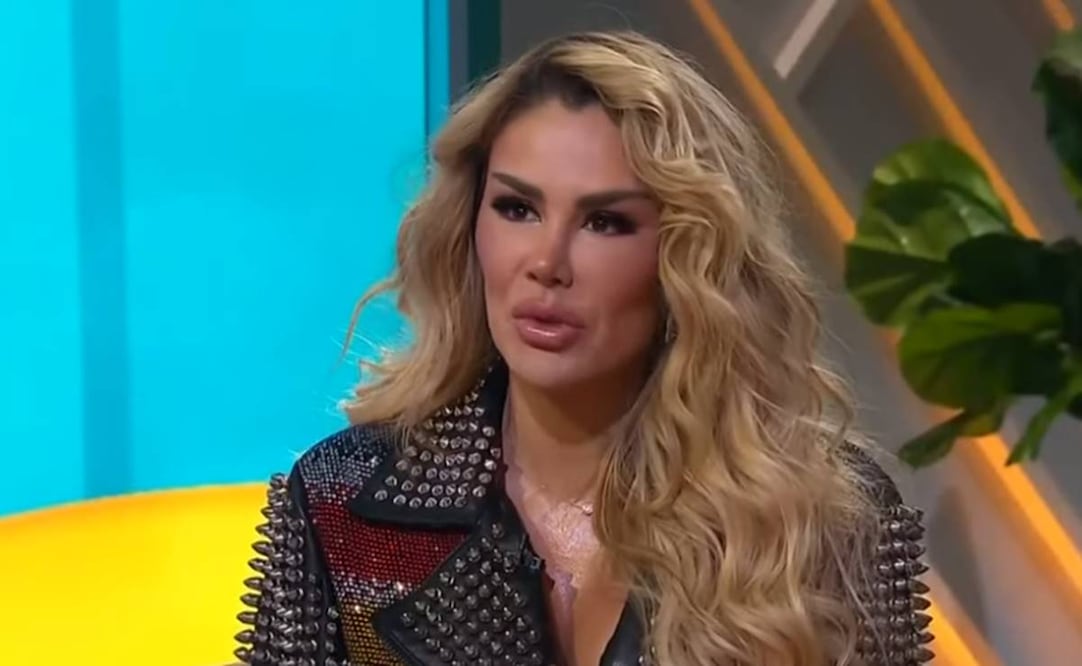 Ninel Conde está dando de qué hablar por cómo luce su rostro en el programa "Hoy Día".