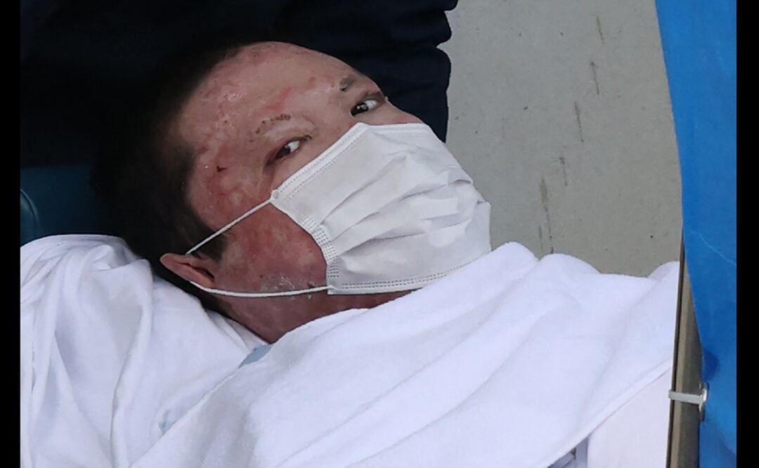 Shinji Aoba, que admitió haber iniciado un incendio que mató a 36 personas en un estudio de anime en 2019, se enfrenta a la pena de muerte. Foto: AFP