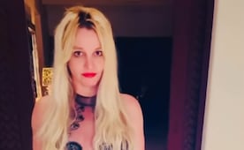 Britney Spears revela incómodo resultado tras aplicarse bótox