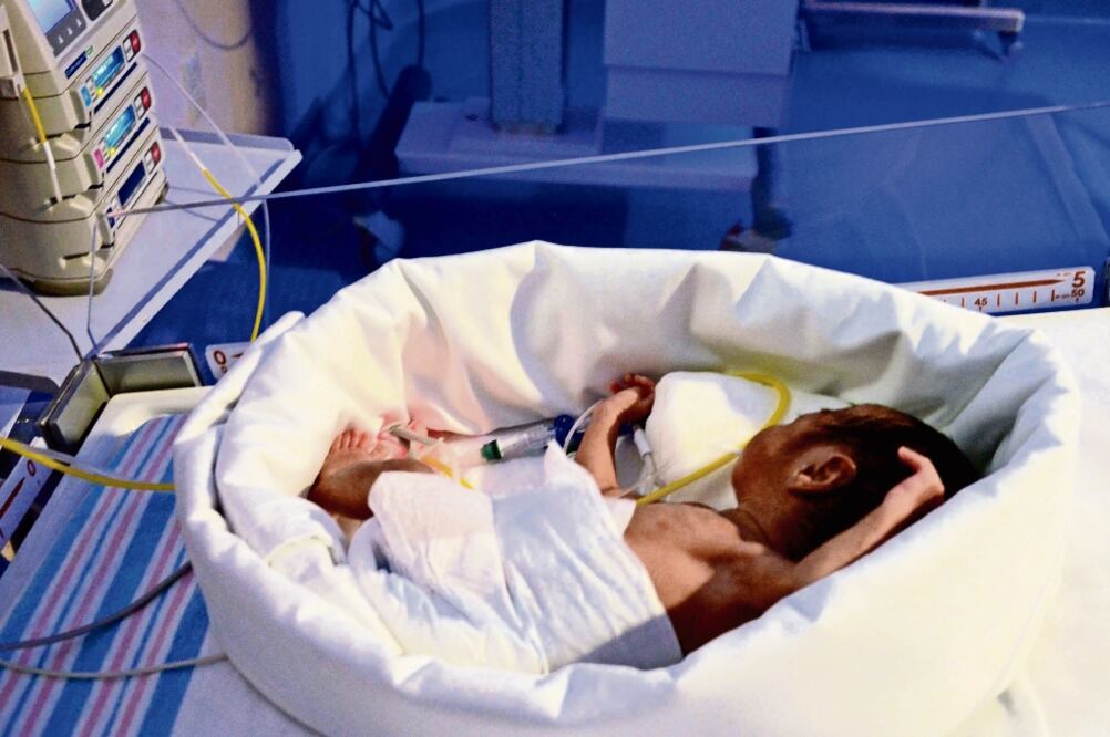 Con el programa Neurohabilitación para Menores de Tres Meses Diagnosticados con Daño Cerebral se busca reducir las secuelas de este padecimiento en los recién nacidos, a través de ejercicios físicos, de visión, audición y cognoscitivos (CORTESÍA SECRETAR)