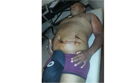 Registran 4 heridos por enfrentamiento en Tepalcatepec