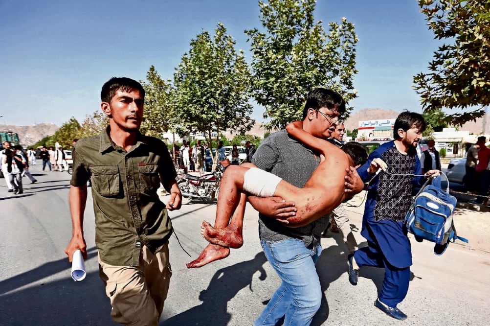 Un menor herido es llevado a un hospital después de una explosión contra una marcha de protesta de la minoría chiíta hazara, en Kabul, Afganistán, ayer (RAHMAT GUL. AP)