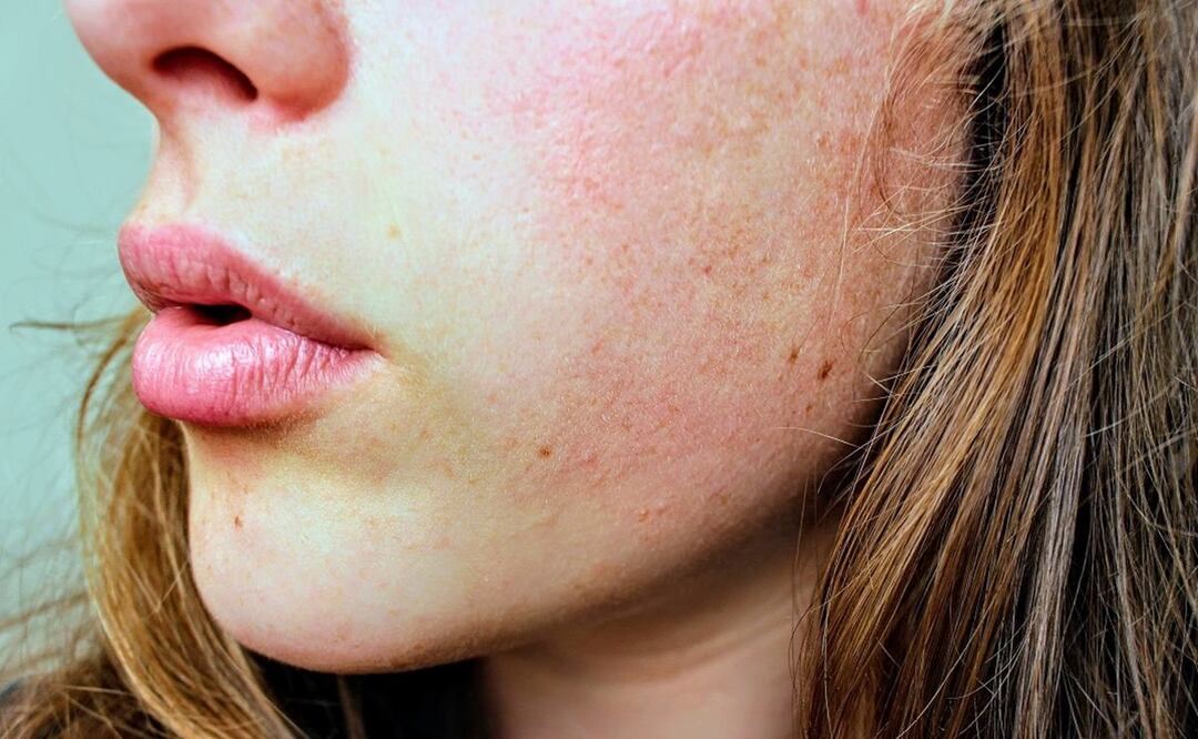 La piel seca necesita mimos extra / Foto: Pexels