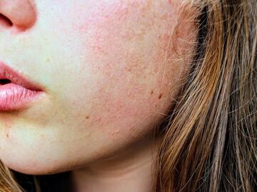 ¿Piel seca?: 7 errores que debes evitar en tu rutina facial