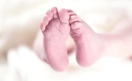 Bebé es adorado por nacer con 4 brazos y 4 piernas; "es la reencarnación de un Dios", dicen