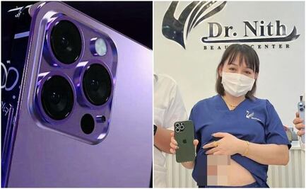 Critican a clínica por promoción de iPhone 14 a cambio de un riñón