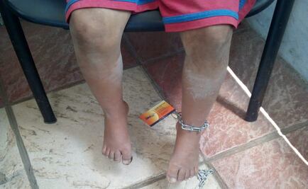 Rescatan a dos niñas golpeadas y encadenadas a una cama en Aguascalientes