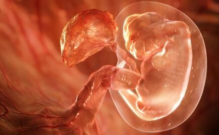 UNAM students develop treatment to repair cleft lip in womb