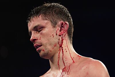 "Bandido" Vargas derrotó con polémica a Stephen Smith