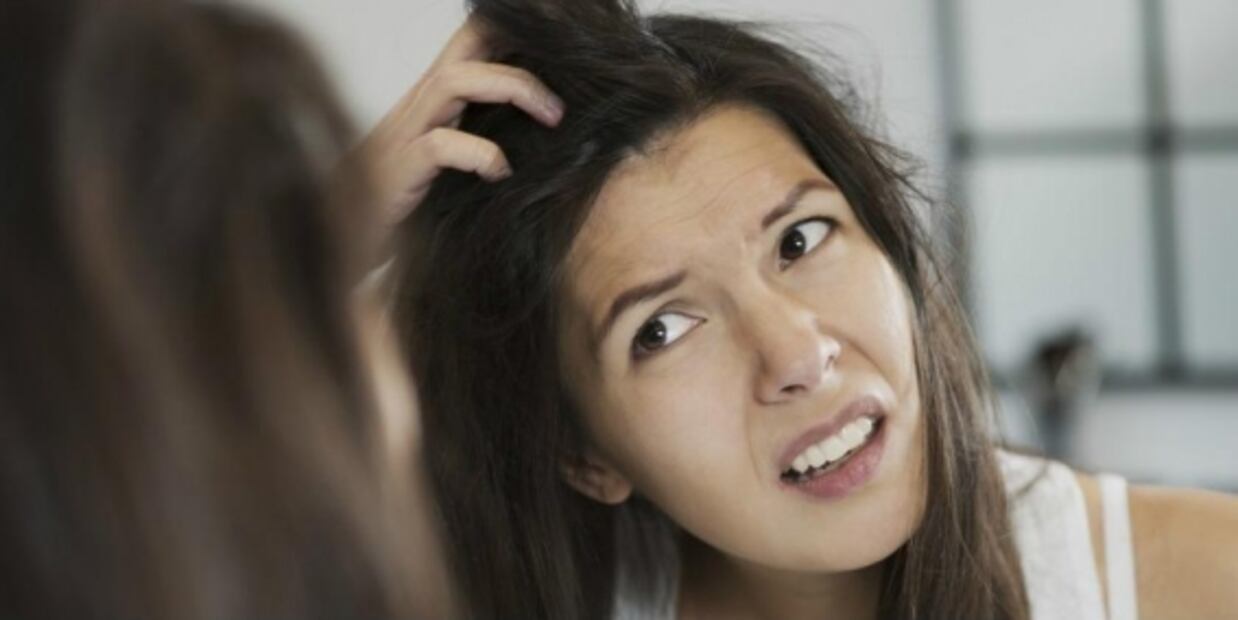 Los remedios naturales más efectivos contra la caspa