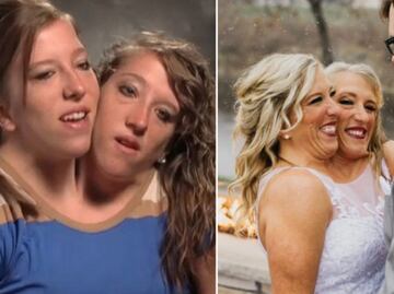 Gemela siamesa se casa con veterano; así es su vida íntima, con su hermana al lado