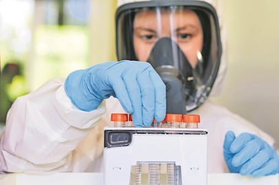 Covid-19, enfermedad por el nuevo coronavirus SARS-CoV-2