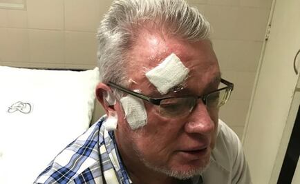 Golpean a médico del IMSS mientras atendía a paciente en Guanajuato