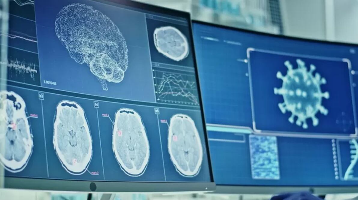 Foto: Getty Images, vía BBc