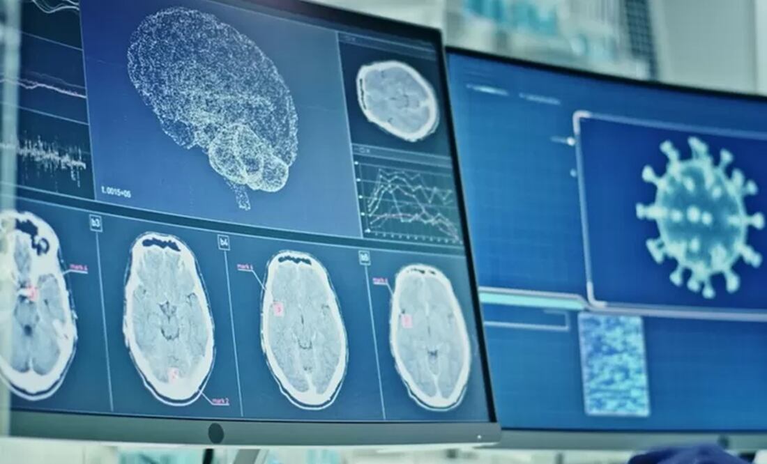 Foto: Getty Images, vía BBc