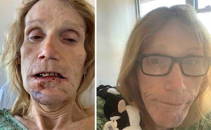 Encierran a mujer trans en cárcel de hombres en California; uno le rompe la mandíbula