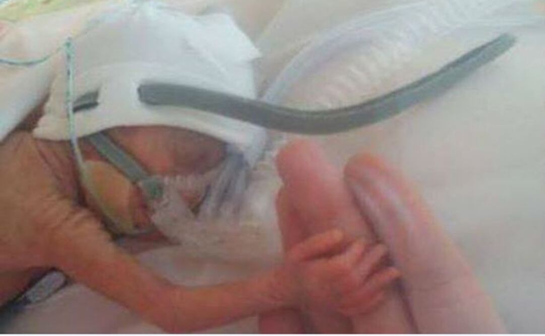 Preemies are not fully ready for life outside the womb - File photo/EL UNIVERSAL