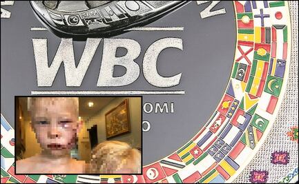 CMB nombra campeón a niño que salvó a su hermana del ataque de un perro