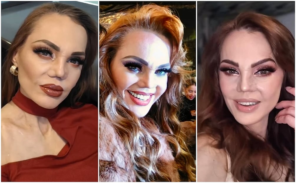 Así luce la modelo Carmen Campuzano en 2026 tras batallar por muchos años con el aspecto de su nariz.