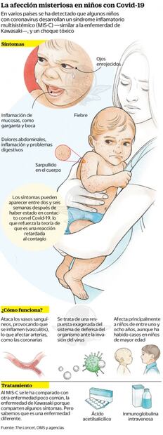 Síndrome inflamatorio infantil: la amenaza a niños relacionada con Covid-19