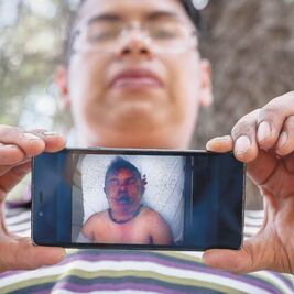 “Ocho personas me golpearon... me llamaban ladrón”, dice joven linchado