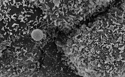 Ivermectina e hidroxicloroquina, medicamentos dudosos contra el Covid-19