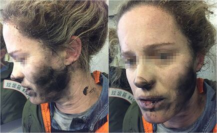 Estallan auriculares en pleno vuelo; causan quemaduras a joven