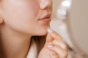 Quiénes no deberían usar parches de acné