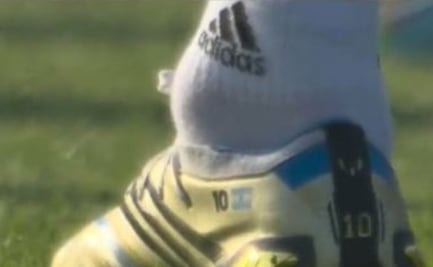 Qatar 2022: La preocupante imagen del tobillo de Lionel Messi a horas de debutar en el Mundial