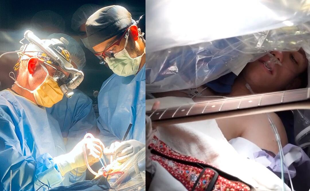 El médico a cargo de la cirugía explicó la razón por la que el paciente tuvo que tocar la guitarra. Foto: Instagram