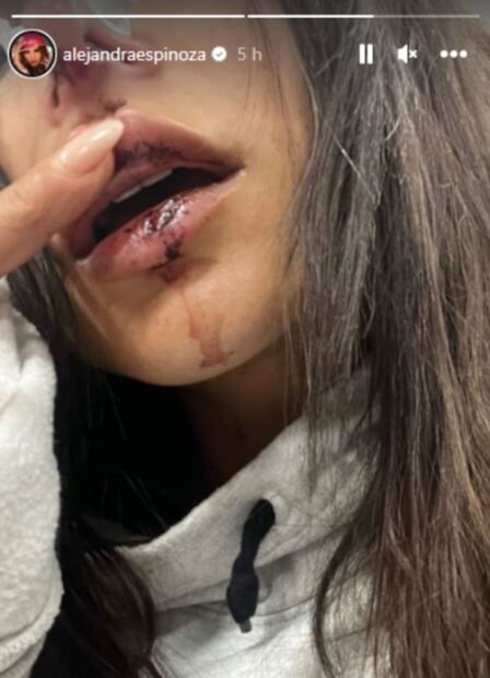 Alejandra Espinoza: Presentadora y actriz mexicana sufre fuerte accidente 