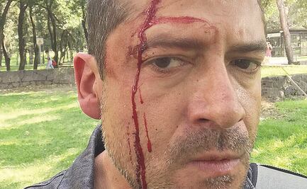 Vendedores de droga golpean a periodista en CU de la UNAM