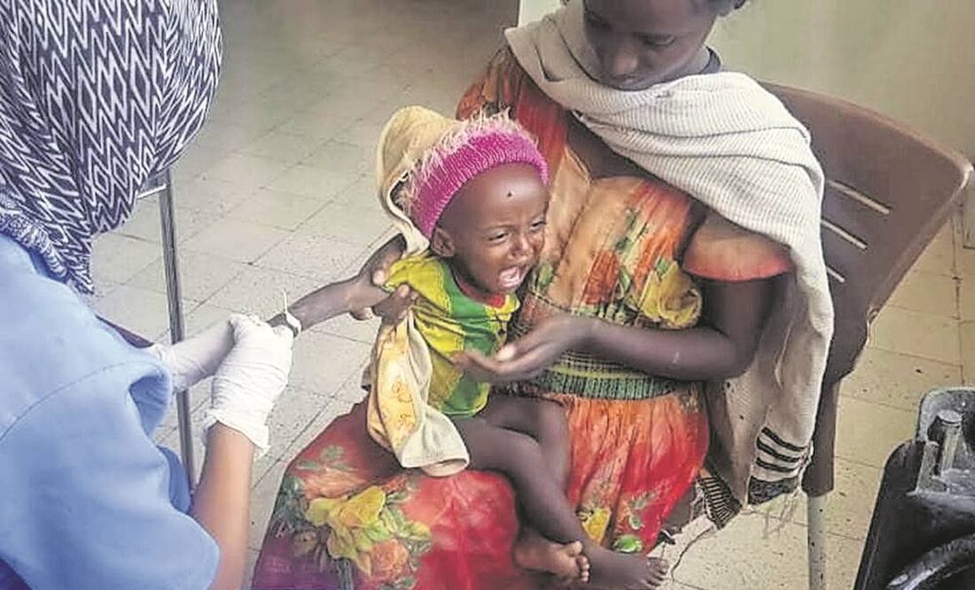 Medhin Gereziher, de un año, al recibir en 2022 tratamiento por desnutrición en un hospital en Mekele, en Tigray, Etiopía. Foto: Archivo/ AP